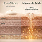 Vergleich: Creme wirkt oberflächlich, Microneedle Patch bringt Wirkstoffe durch die Hautbarriere (+380 % Wirkstoff-Aufnahme)