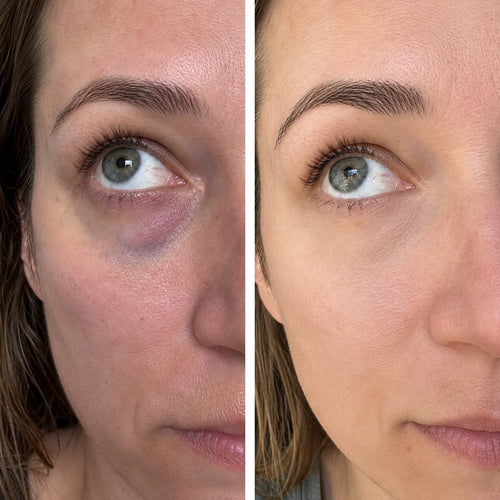 Ergebnis von Melanie K., 40