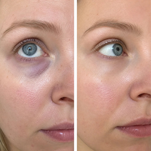 Ergebnis von Tina B., 33